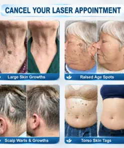 𝑵𝒆𝒌𝐢𝐬𝐬® 𝐌𝐢𝐜𝐫𝐨𝐧𝐞𝐞𝐝𝐥𝐞 𝐅𝐥𝐚𝐰𝐥𝐞𝐬𝐬 𝐒𝐤𝐢𝐧 𝐏𝐚𝐭𝐜𝐡 Painless & Scar-Free Advanced Skin Imperfection Removal Patch